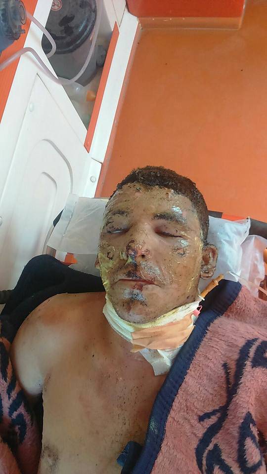 Un medico siriano: &#8220;Isis ha usato gas contro i civili&#8221;