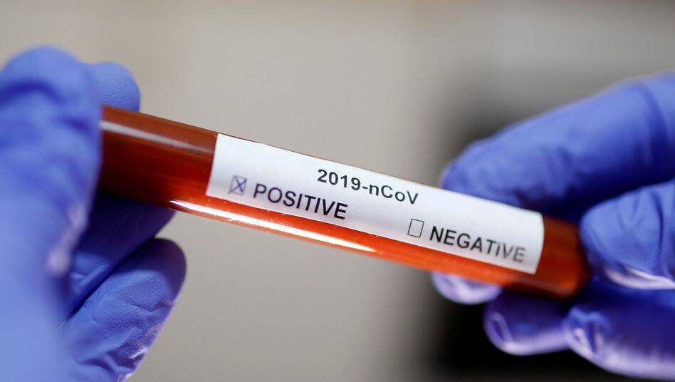 Coronavirus, test sierologici gratuiti in farmacia per studenti e famiglie